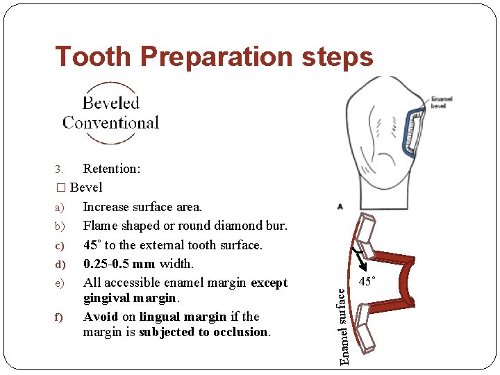 Tooth Preparation steps Retention: � Bevel a) Increase surface area. b) Flame shaped or