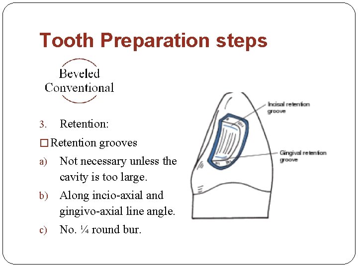 Tooth Preparation steps 3. Retention: � Retention grooves a) Not necessary unless the cavity
