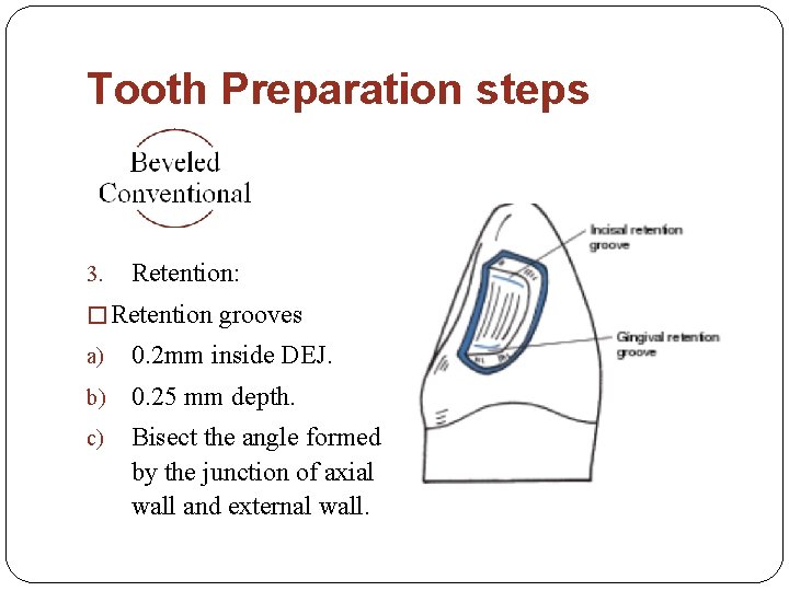 Tooth Preparation steps 3. Retention: � Retention grooves a) 0. 2 mm inside DEJ.