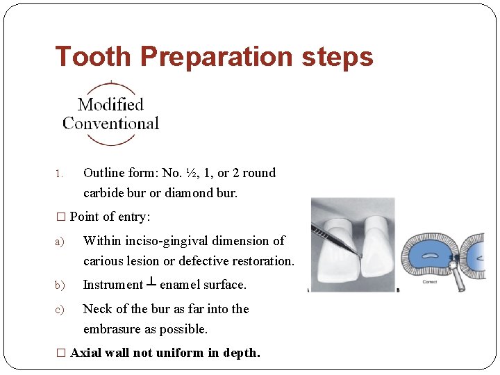 Tooth Preparation steps 1. Outline form: No. ½, 1, or 2 round carbide bur