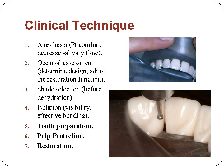 Clinical Technique 1. 2. 3. 4. 5. 6. 7. Anesthesia (Pt comfort, decrease salivary