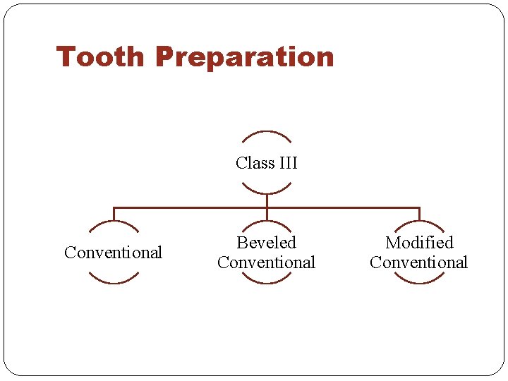 Tooth Preparation Class III Conventional Beveled Conventional Modified Conventional 