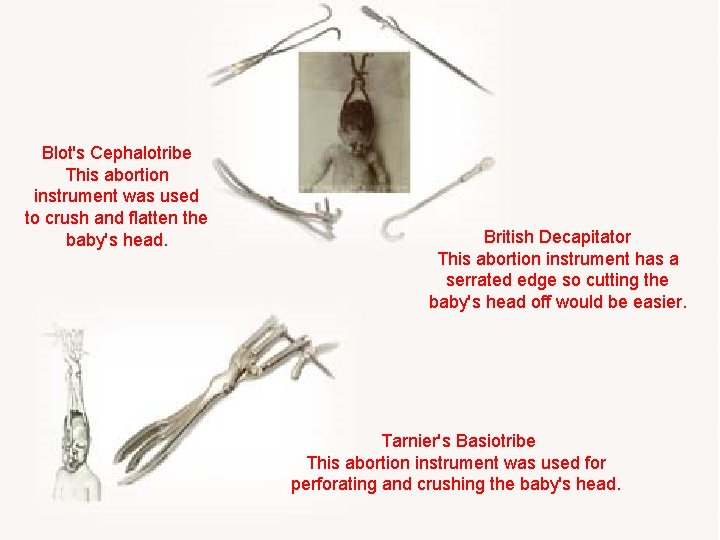 Blot's Cephalotribe This abortion instrument was used to crush and flatten the baby's head.