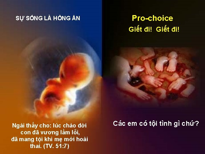 SỰ SỐNG LÀ HỒNG N Pro-choice Giết đi! Ngài thấy cho: lúc chào đời