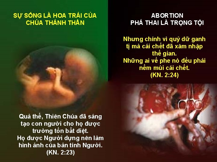 SỰ SỐNG LÀ HOA TRÁI CỦA CHÚA THÁNH THẦN ABORTION PHÁ THAI LÀ TRỌNG