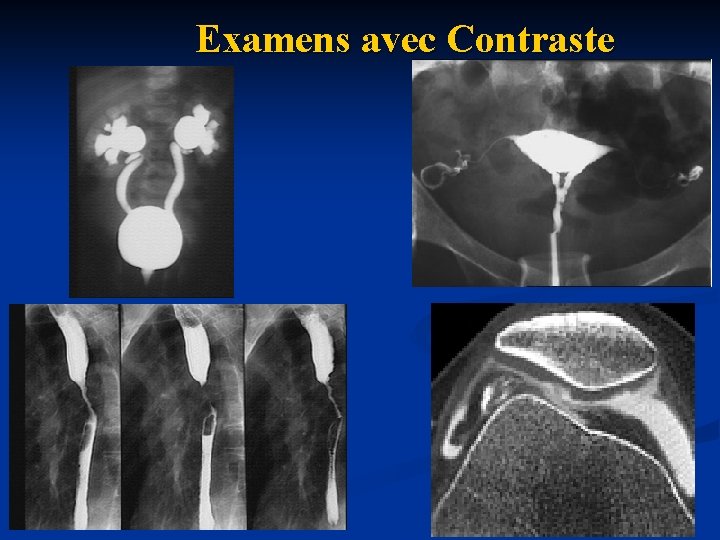 Examens avec Contraste 