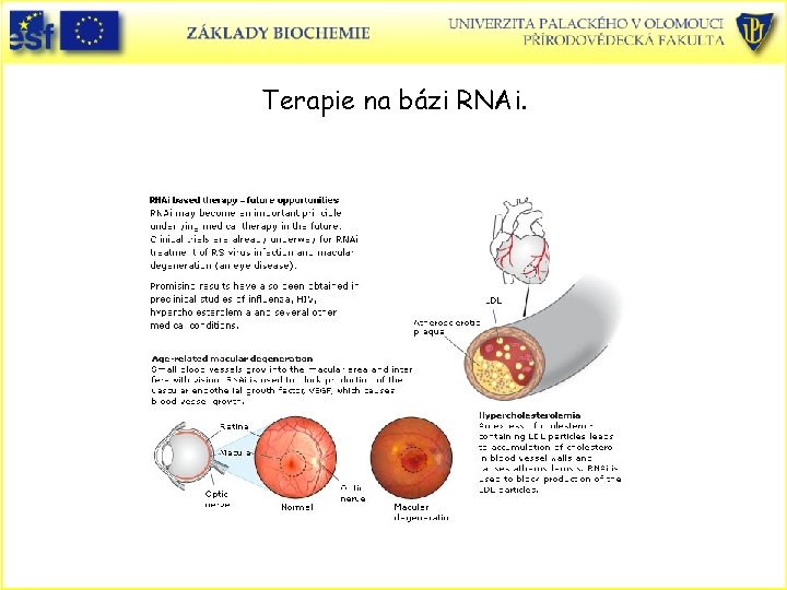 Terapie na bázi RNAi. 