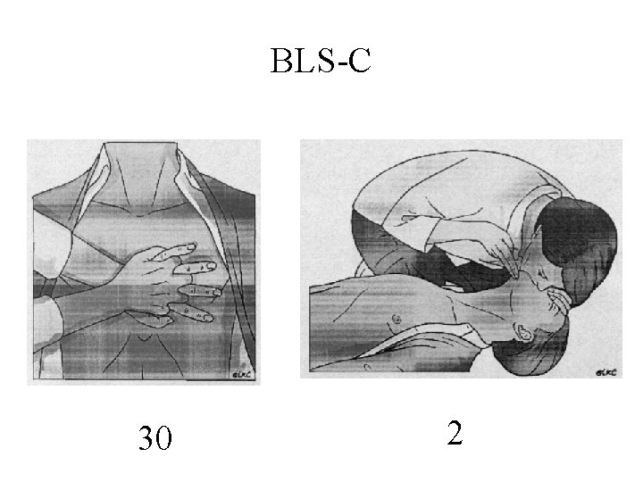 BLS-C 30 2 