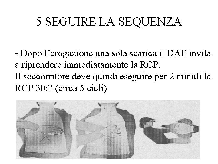 5 SEGUIRE LA SEQUENZA - Dopo l’erogazione una sola scarica il DAE invita a