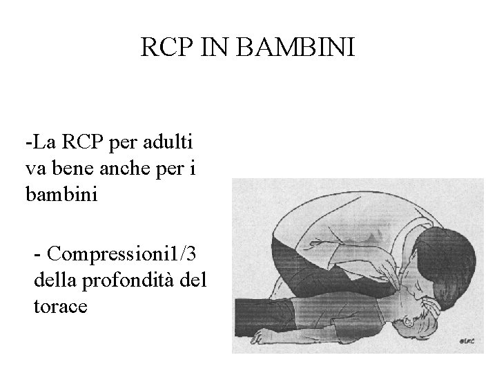 RCP IN BAMBINI -La RCP per adulti va bene anche per i bambini -