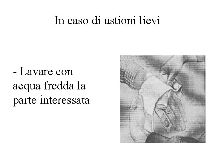 In caso di ustioni lievi - Lavare con acqua fredda la parte interessata 