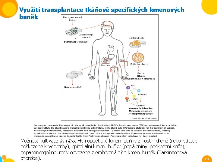 Využití transplantace tkáňově specifických kmenových buněk Možnost kultivace in vitro. Hemopoetické kmen. buňky z