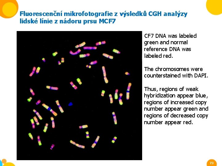 Fluorescenční mikrofotografie z výsledků CGH analýzy lidské línie z nádoru prsu MCF 7 DNA