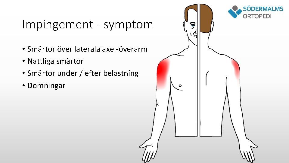Impingement - symptom • Smärtor över laterala axel-överarm • Nattliga smärtor • Smärtor under