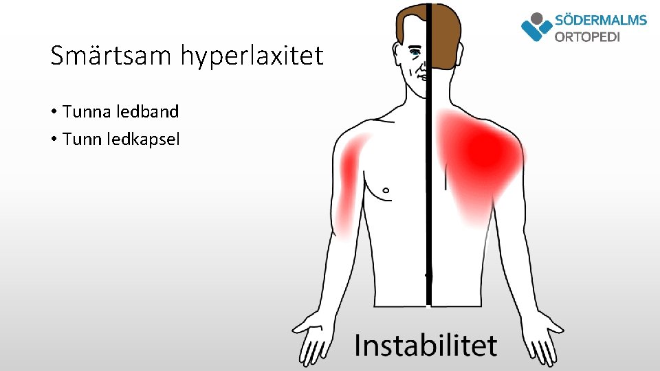 Smärtsam hyperlaxitet • Tunna ledband • Tunn ledkapsel 