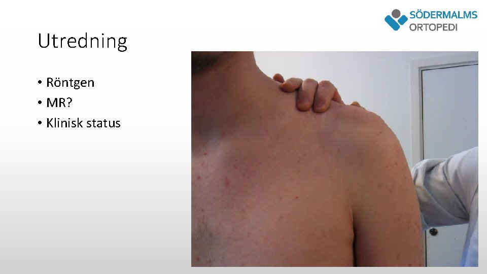 Utredning • Röntgen • MR? • Klinisk status 