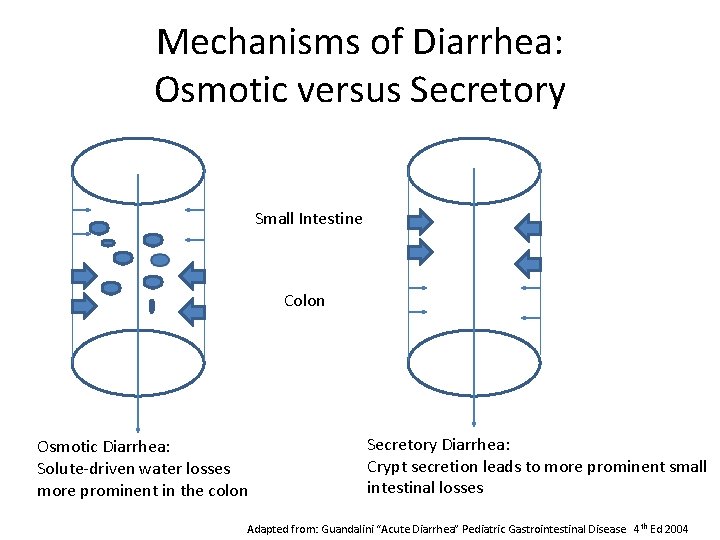 Mechanisms of Diarrhea: Osmotic versus Secretory Small Intestine Colon Osmotic Diarrhea: Solute-driven water losses