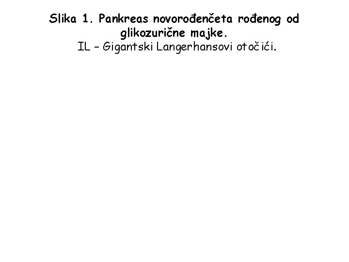 Slika 1. Pankreas novorođenčeta rođenog od glikozurične majke. IL – Gigantski Langerhansovi otočići. 