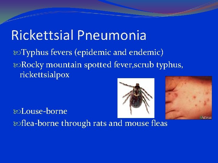 Rickettsial Pneumonia Typhus fevers (epidemic and endemic) Rocky mountain spotted fever, scrub typhus, rickettsialpox