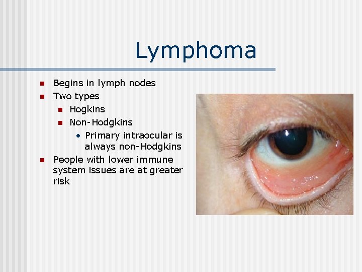 Lymphoma n n n Begins in lymph nodes Two types n Hogkins n Non-Hodgkins