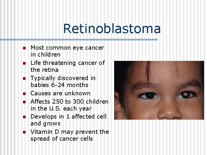 Retinoblastoma n n n n Most common eye cancer in children Life threatening cancer