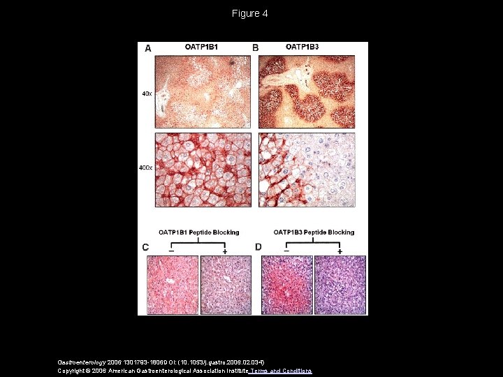 Figure 4 Gastroenterology 2006 1301793 -1806 DOI: (10. 1053/j. gastro. 2006. 02. 034) Copyright