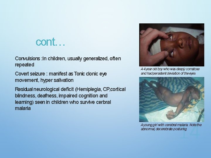 cont… Convulsions : In children, usually generalized, often repeated Covert seizure : manifest as