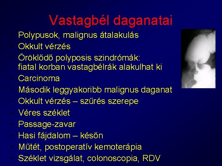 Vastagbél daganatai • Polypusok, malignus átalakulás • Okkult vérzés • Öröklődő polyposis szindrómák: fiatal