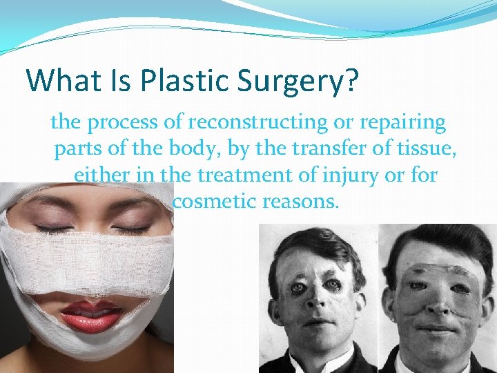 What Is Plastic Surgery? the process of reconstructing or repairing parts of the body,