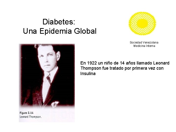 Diabetes: Una Epidemia Global Sociedad Venezolana Medicina Interna En 1922 un niño de 14