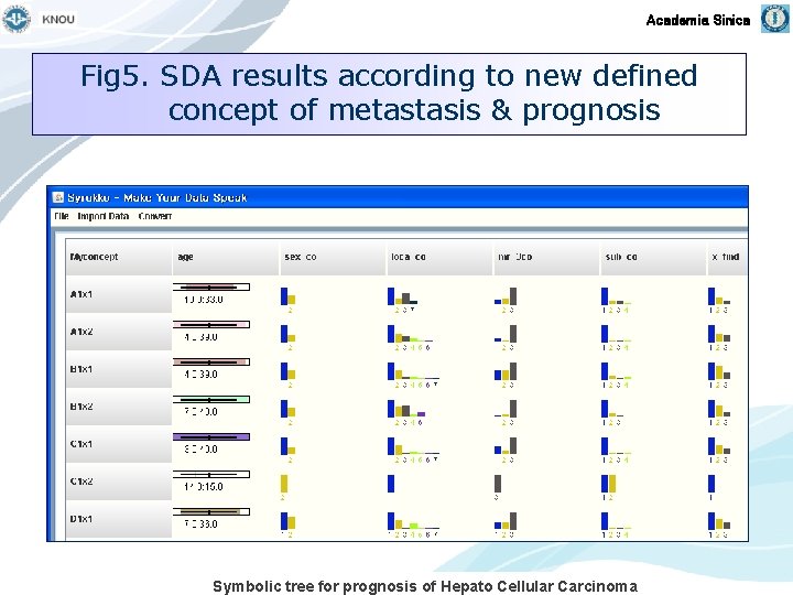 Academia Sinica Fig 5. SDA results according to new defined concept of metastasis &