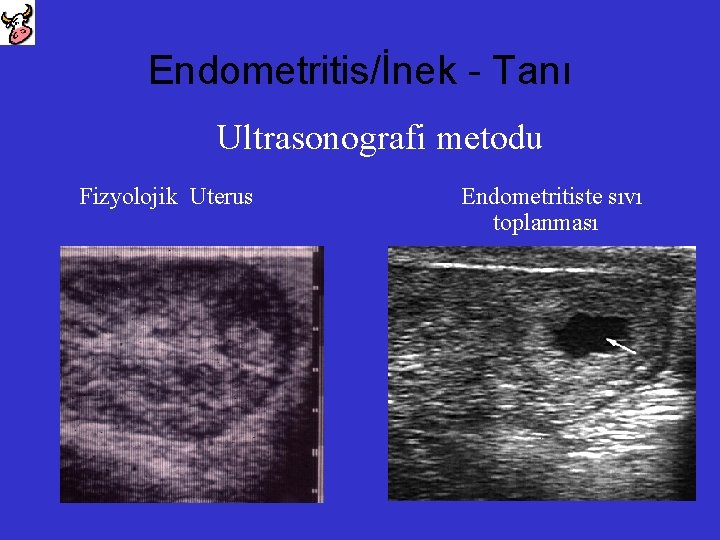 Endometritis/İnek - Tanı Ultrasonografi metodu Fizyolojik Uterus Endometritiste sıvı toplanması 