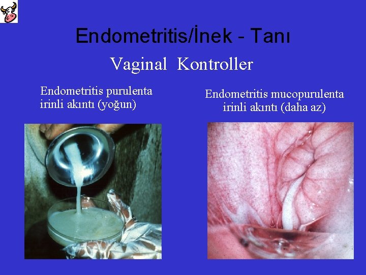 Endometritis/İnek - Tanı Vaginal Kontroller Endometritis purulenta irinli akıntı (yoğun) Endometritis mucopurulenta irinli akıntı