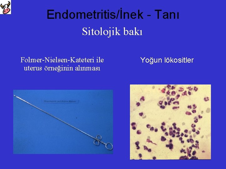 Endometritis/İnek - Tanı Sitolojik bakı Folmer-Nielsen-Kateteri ile uterus örneğinin alınması Yoğun lökositler 