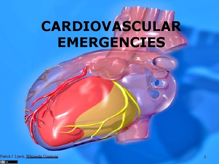 CARDIOVASCULAR EMERGENCIES Patrick J. Lynch, Wikimedia Commons 3 