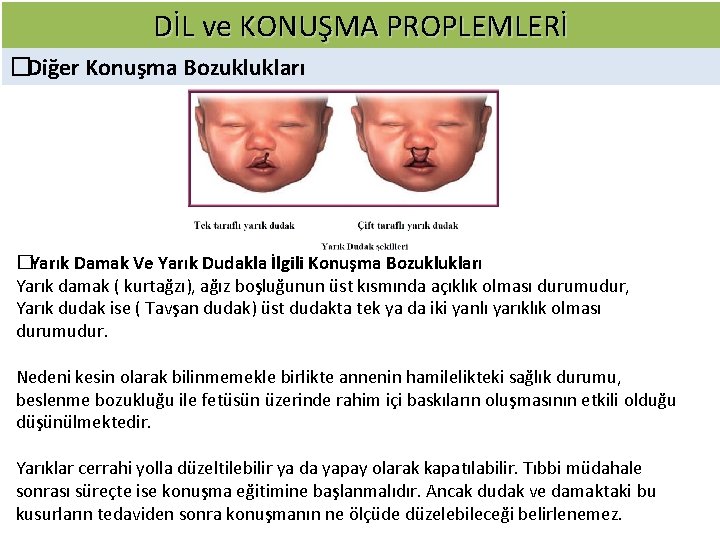 DİL ve KONUŞMA PROPLEMLERİ � Diğer Konuşma Bozuklukları � Yarık Damak Ve Yarık Dudakla