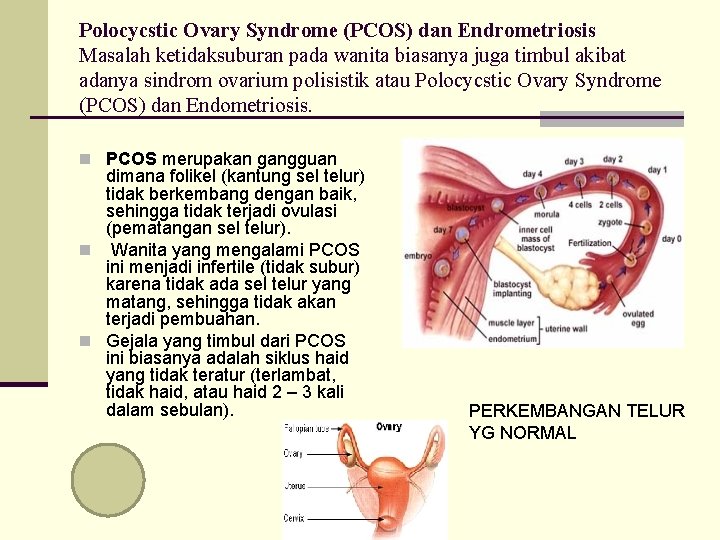 Polocycstic Ovary Syndrome (PCOS) dan Endrometriosis Masalah ketidaksuburan pada wanita biasanya juga timbul akibat