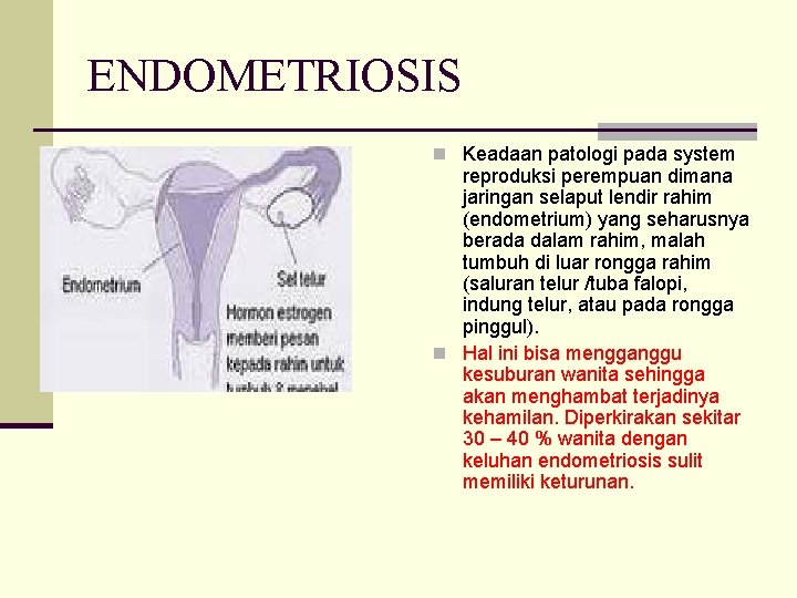 ENDOMETRIOSIS n Keadaan patologi pada system reproduksi perempuan dimana jaringan selaput lendir rahim (endometrium)