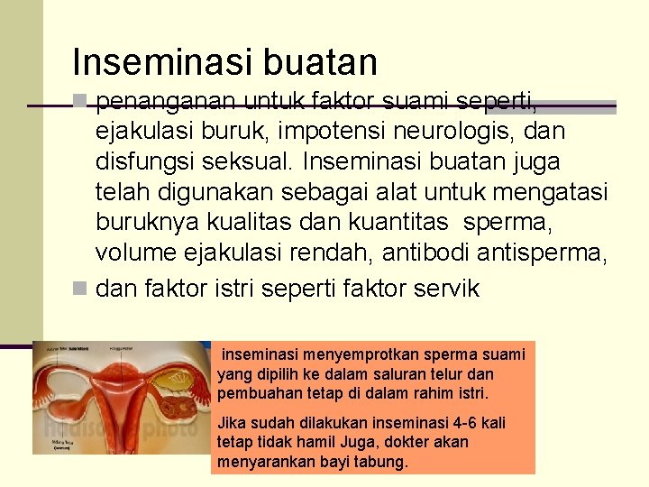 Inseminasi buatan n penanganan untuk faktor suami seperti, ejakulasi buruk, impotensi neurologis, dan disfungsi