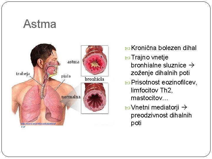 Astma Kronična bolezen dihal Trajno vnetje pljuča http: //www. bronhitis. rs/bolesti/ast ma/ bronhialne sluznice