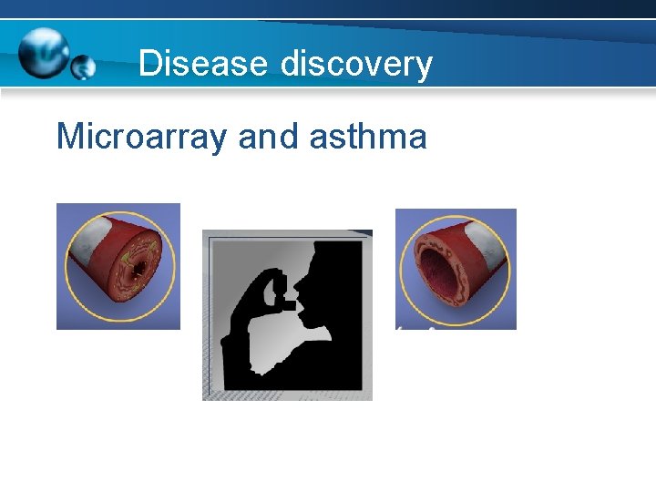 Disease discovery Microarray and asthma 