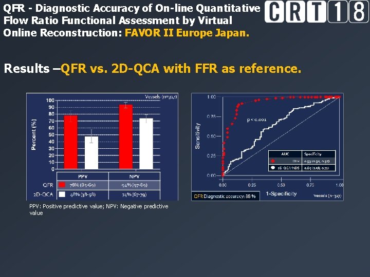 QFR - Diagnostic Accuracy of On-line Quantitative Flow Ratio Functional Assessment by Virtual Online