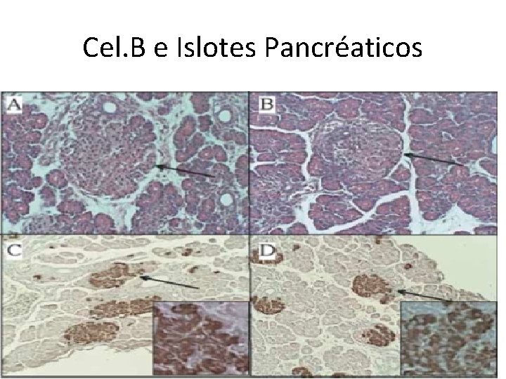 Cel. B e Islotes Pancréaticos 