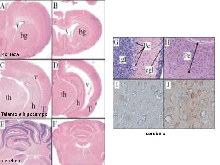 corteza Tálamo e hipocampo cerebelo 