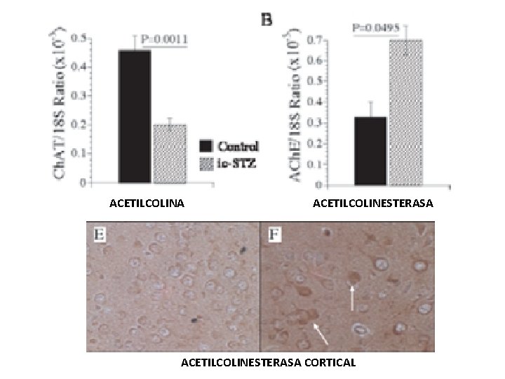 ACETILCOLINA ACETILCOLINESTERASA CORTICAL 