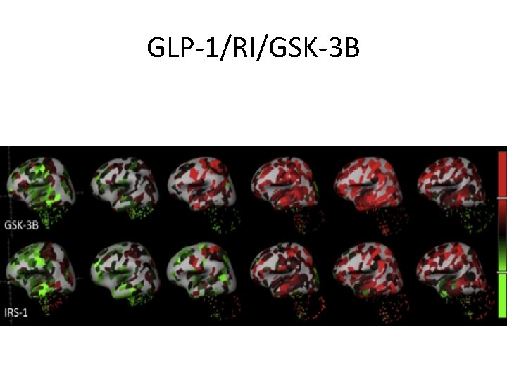 GLP-1/RI/GSK-3 B 