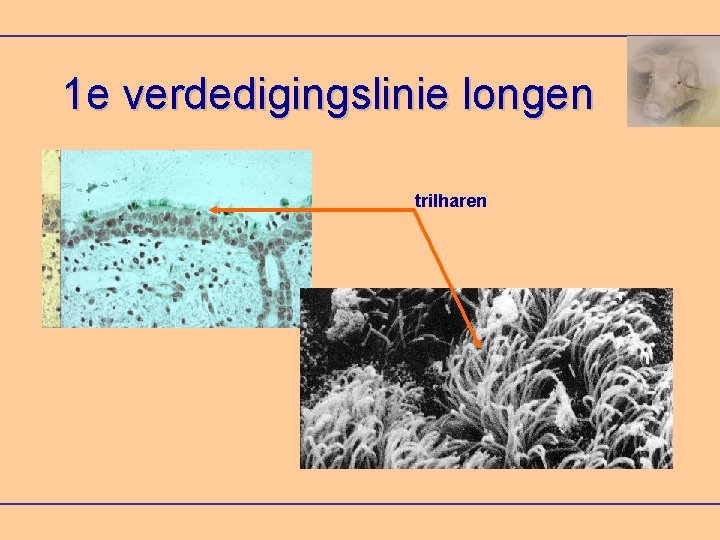 1 e verdedigingslinie longen trilharen 