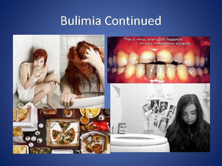 Bulimia Continued 