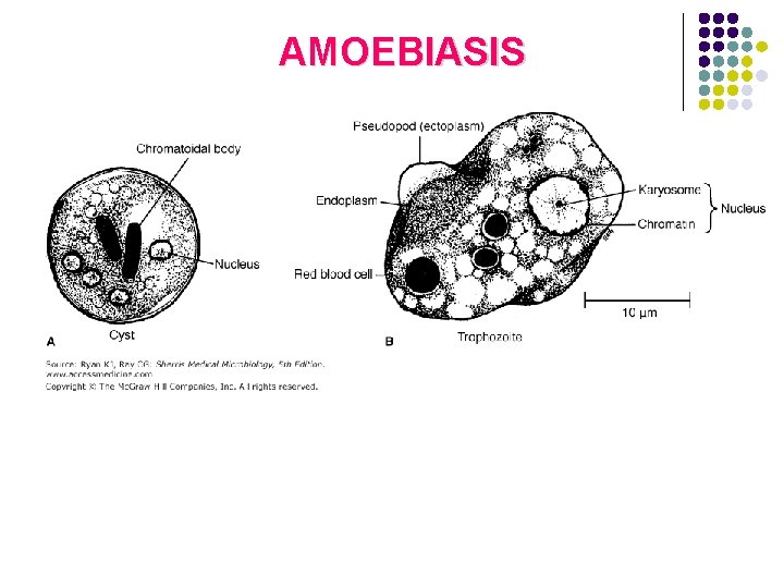 AMOEBIASIS 