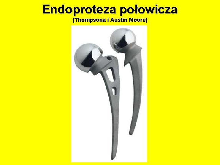 Endoproteza połowicza (Thompsona i Austin Moore) 